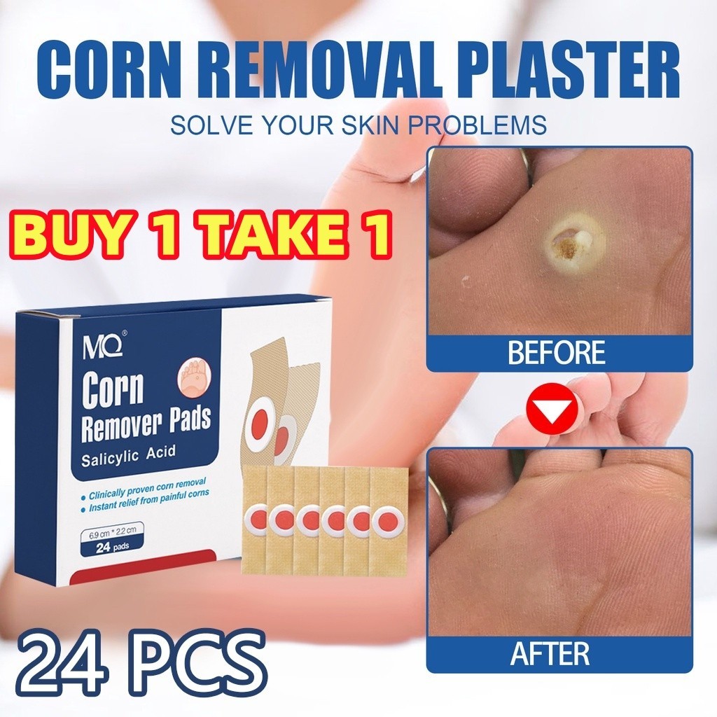 【BUY 1 TAKE 1】24PCS Warts remover Foot Corns Foot care sticker Reduce ...