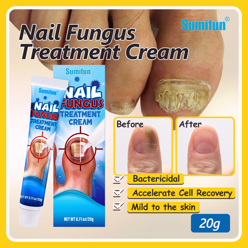 Effective Nail Repair】Sumifun Nail Fungus Treatment Nail Anti Fungal ...