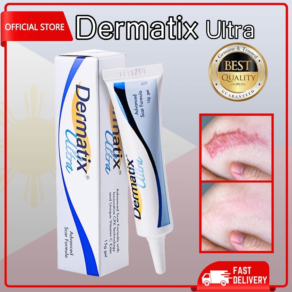 Dermatix Ultra Gel Peklat Remover Cream For Leg Keloid Old Scars ...