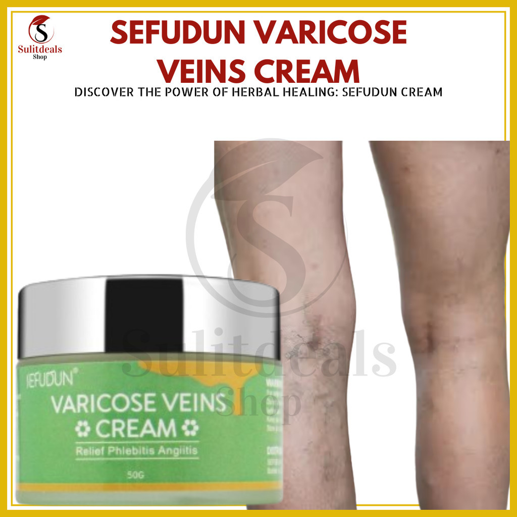 SEFUDUN Varicose Veins Cream Spider Vein Pain Killer Cream ORIGINAL ...