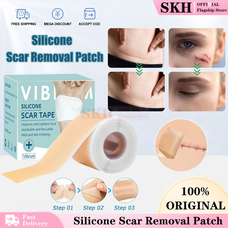 4x150cm Silicone Scar Tape Removal Sticker Patch Silicone Gel Non ...