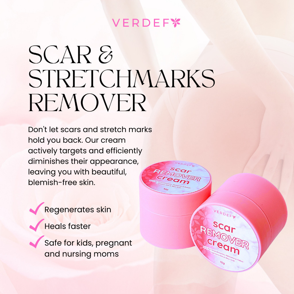 VERDEFY 10g Scar & Stretchmarks Remover Cream Peklat Remover Acne ...