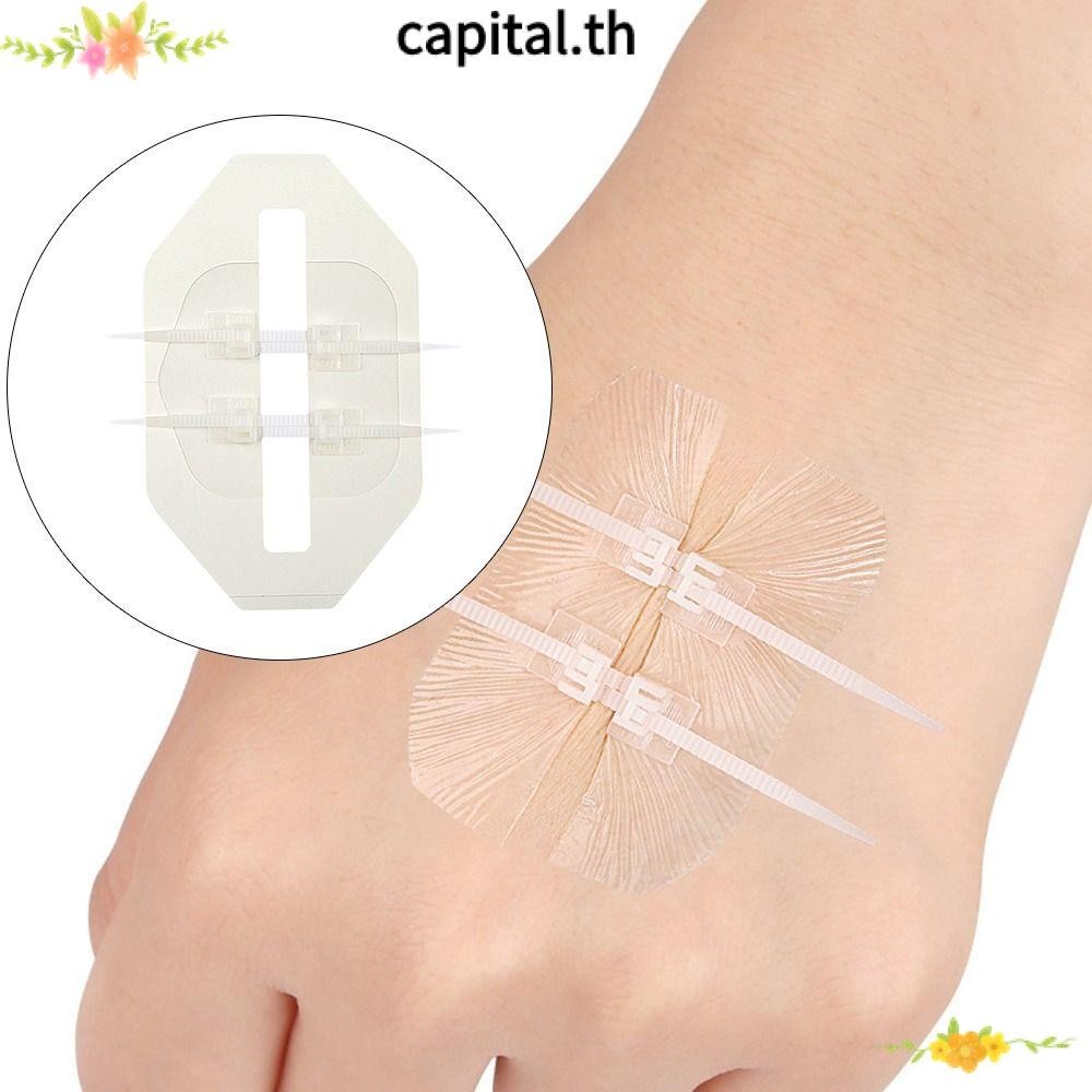 Jorgy Toggle Suture DA Pair - Vet Supply J0191 For Stitches & Wound Care