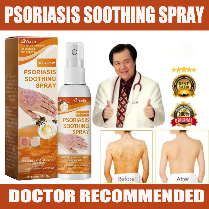 Psoriasis Spray Dermatitis Eczema Relieves itching Ointment /Urea Spray ...