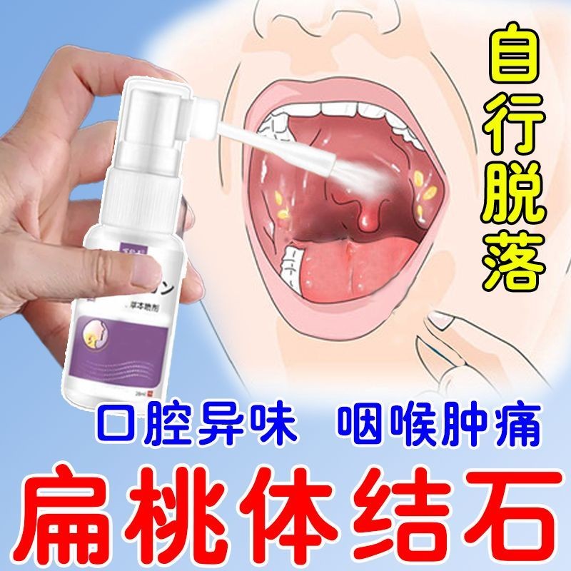 Tonsin Stone Special Spray for Swallowing Difficulty Smelly Throat ...