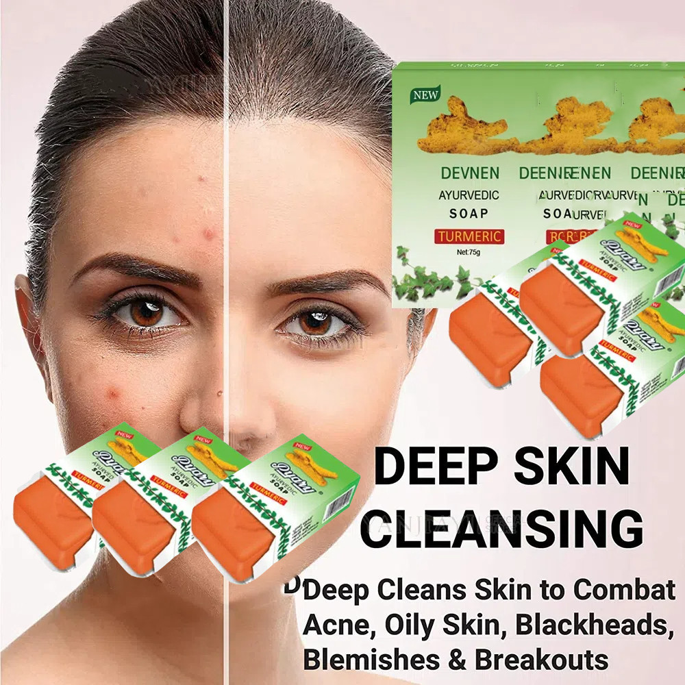 Original Turmeric Soap ROUSHUN Legit and Authentic New 75 Years ...