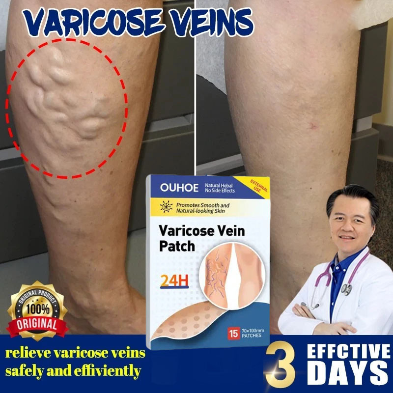 Varicose Vein Remover Spider Vein Pain Killer Patch ORIGINAL Effective ...