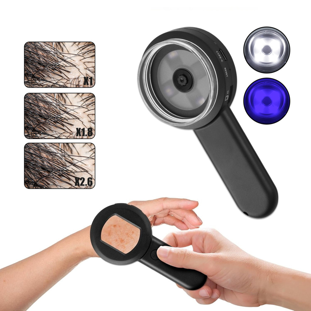 Handheld Dermatoscope Skin Analyzer Machine 100X Scalp Analyzer 16MP ...