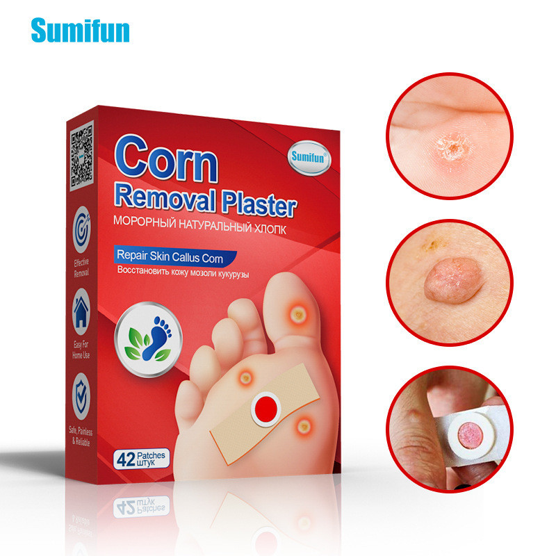 British Russian Corn Patch Corn Patch Corn Paste Foot Ding Ding Wart ...