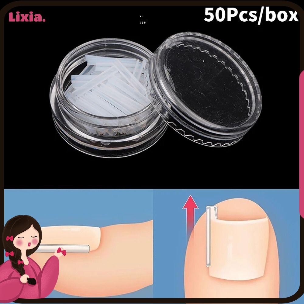 LIXIA 50Pcs/box Ingrown Toenail Correction Tool, Ingrown Toe Nail ...