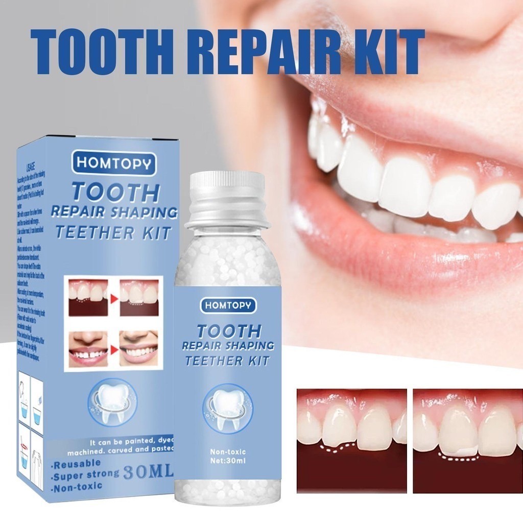 Moldable Teeth Repair Kit Temporary Dentals Replacement Kit Thermal ...