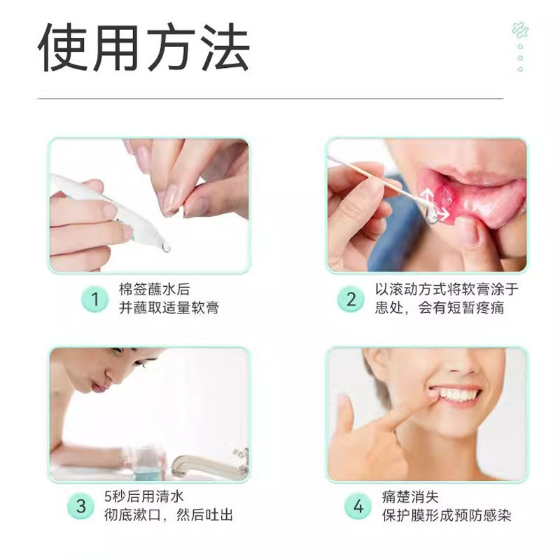 TONENG Industry Oral Ulcer Gel Patch Oral Inflammation Ulcer Repair ...