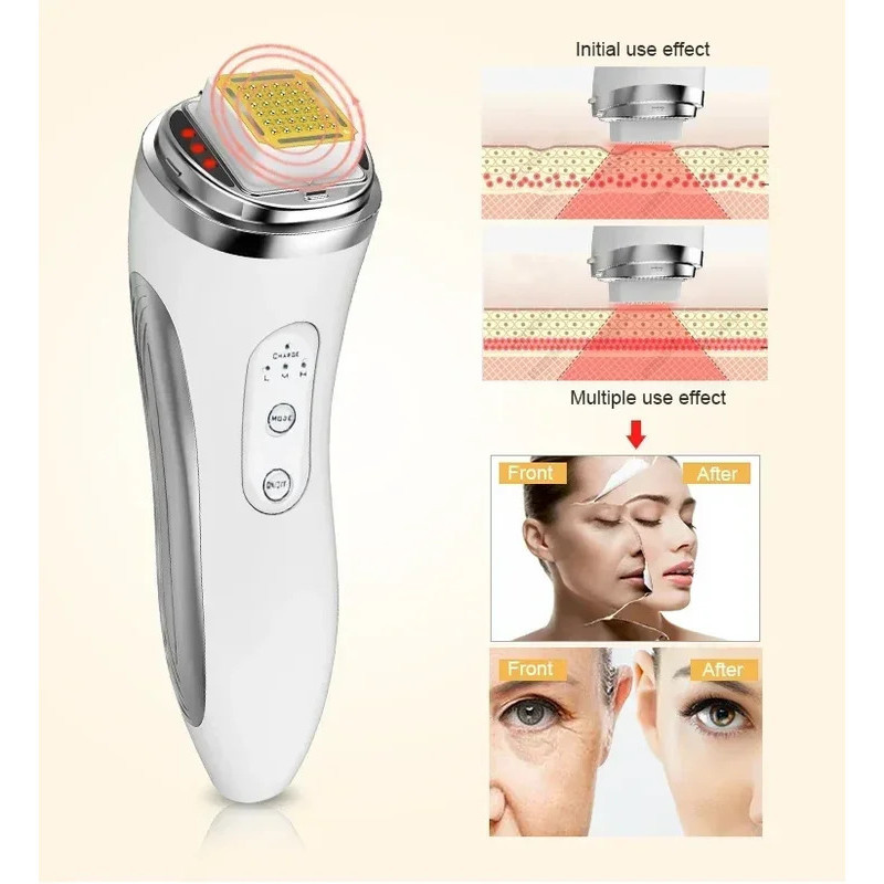 Facial Lifting Machine RF Radio Frequency Dot Matrix Skin Tightening ...