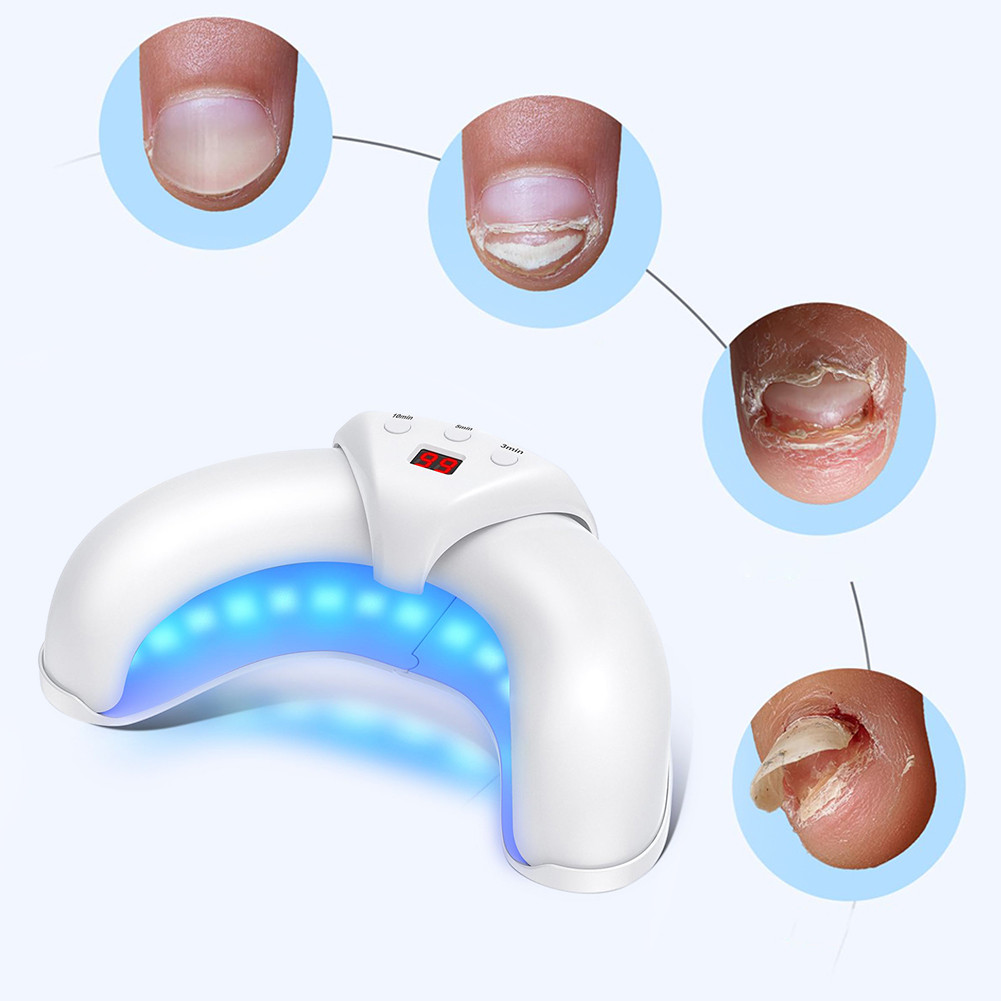 Nail Fungal Light Device Toenail Fungal Cleaning Machine Portable Nail ...