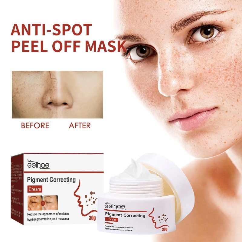 EELHOE Anti Dark Spots Cream Remove Freckle Melasma Age Spots Lighten ...