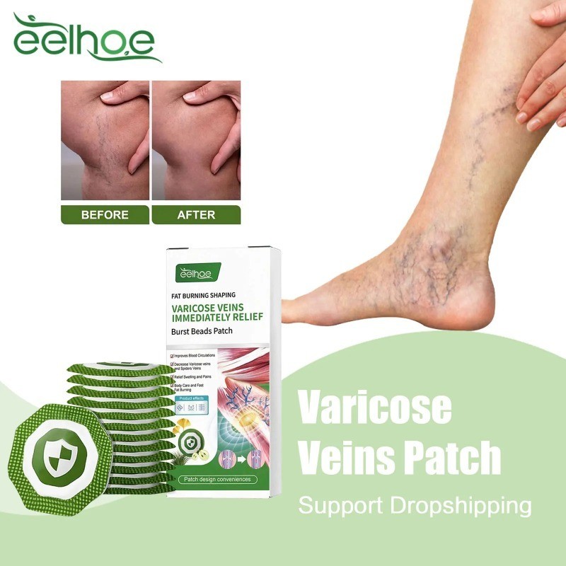 EELHOE Varicose Veins Patch Relieve Leg Swelling Vasculitis Phlebitis ...