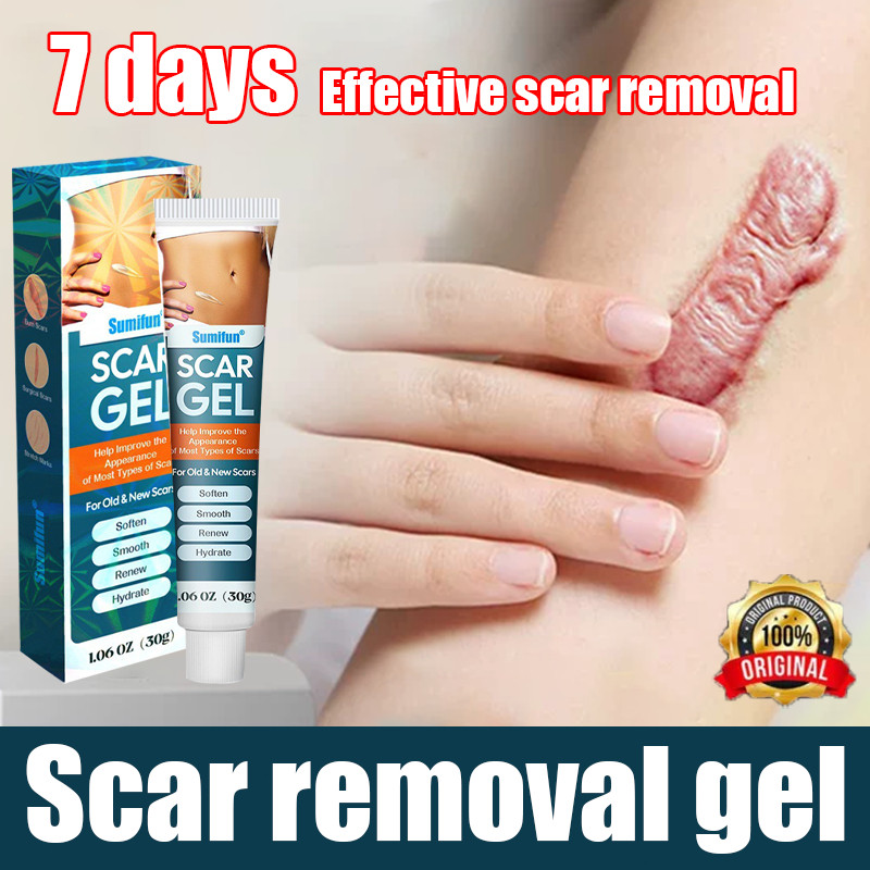 Scar Repair Gel Scars Treatment Gel Scar removal 30g Skin Mark Care ...