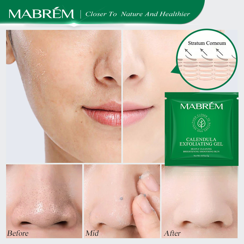 MABREM Calendula Exfoliating Gel Deep Cleansing Oil Control ...