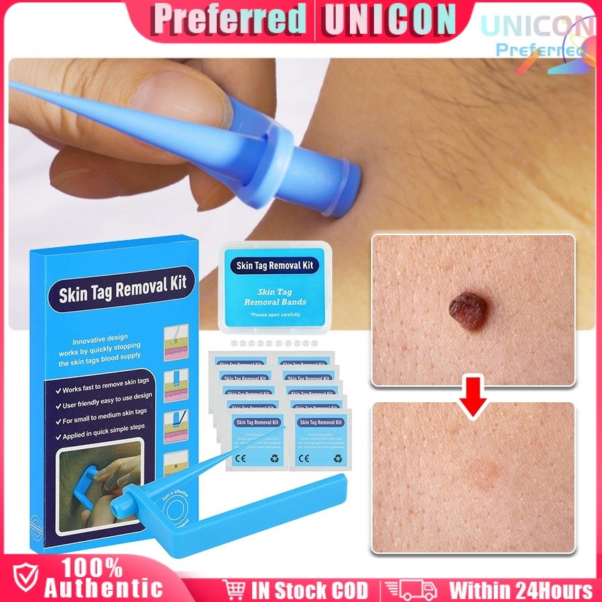 31pcs Skin Tag remover tools Rubber Kit with 10pcs Cleaning Pads 20pcs ...