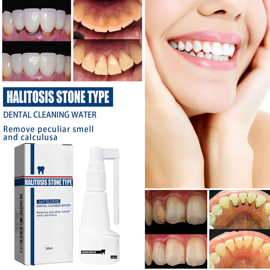 【in stock】jaysuing Remover Plaque Remover Teeth Whitening Tooth Stain ...