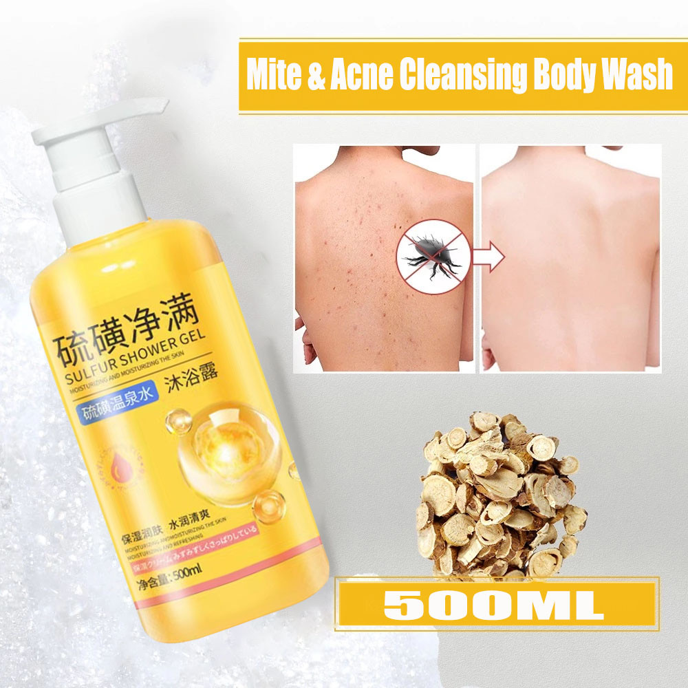Sulfur body wash eliminates mites and bacteriostasis to improve ...