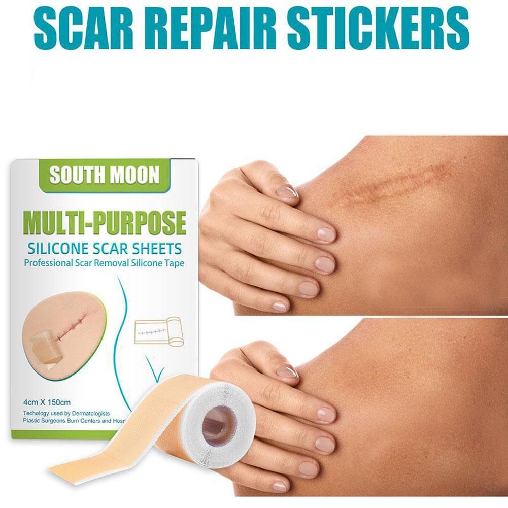Scar Repair Stickers Silicone Gel Scar Repair Stickers 150cm | Shopee ...