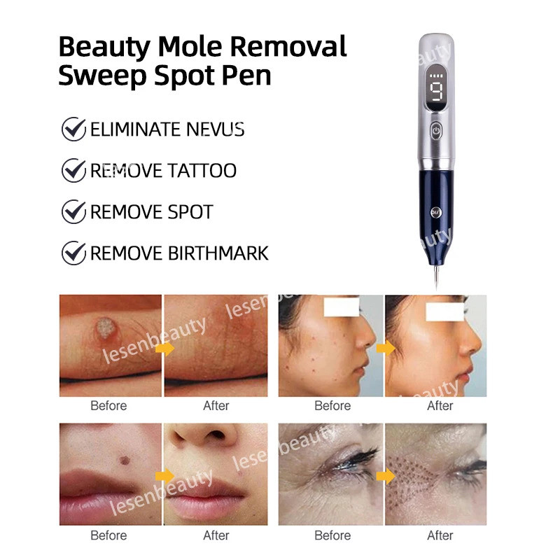 Plasmapen Birthmark Facial Tag Removal Pencil Plasma Pen Cauterizer ...