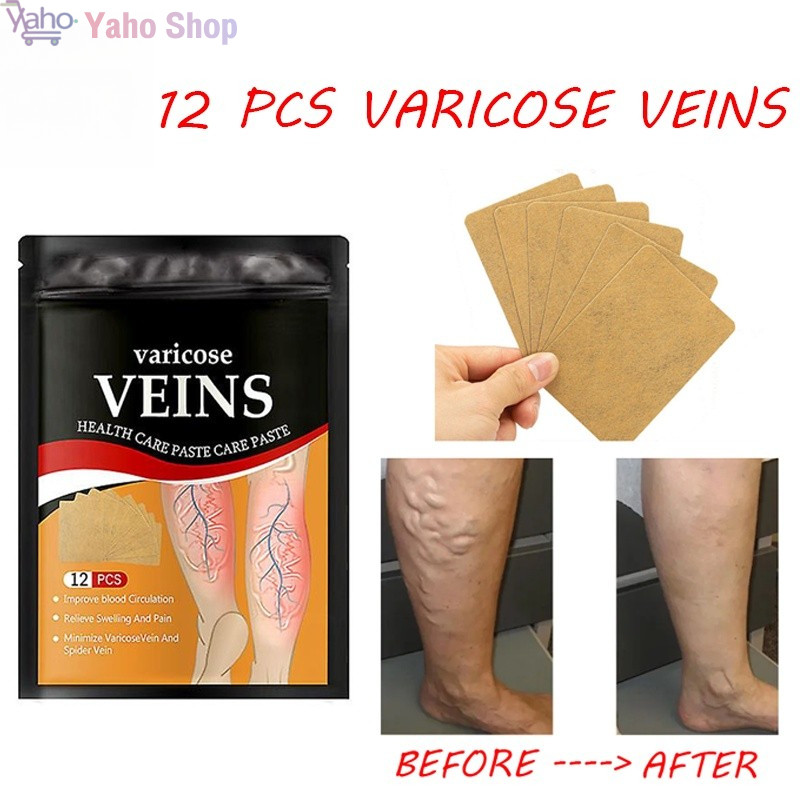12pcs Varicose vein Remover patch pain relief body relief knee Patches ...