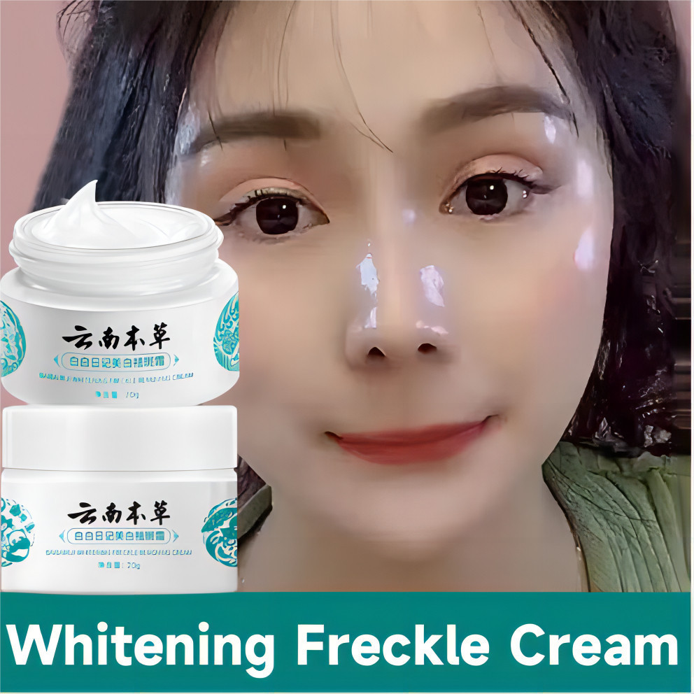 Melasma Cream Yunnan Herbal Whitening Freckle Cream Japanese Melasma ...