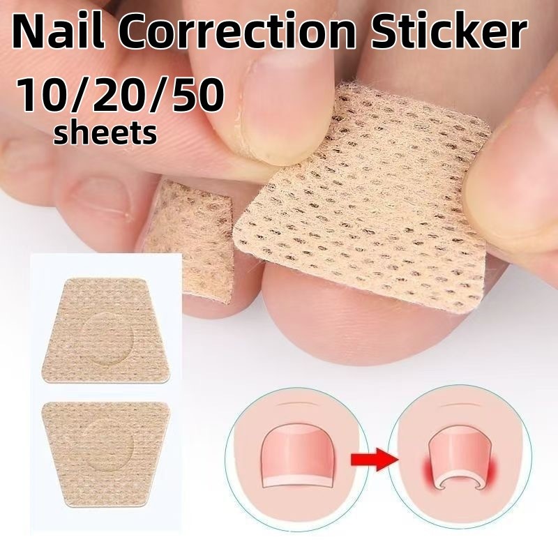 10/20/50Sheets Ingrown Toenail Corrective Stickers Foot Care Ringworm ...