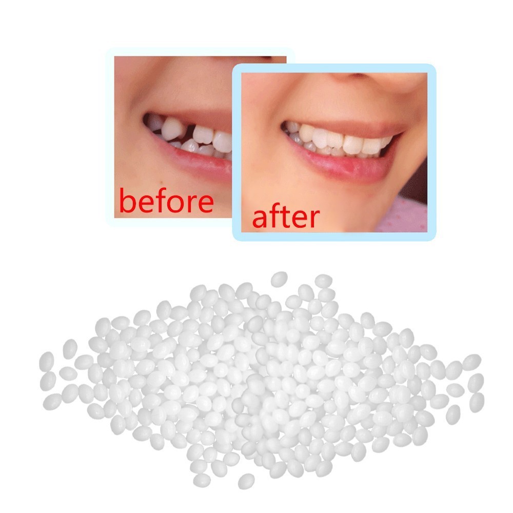 5/10g Tooth Repair Set Vampire Teeth Glue Resin FalseTeeth Solid Glue ...