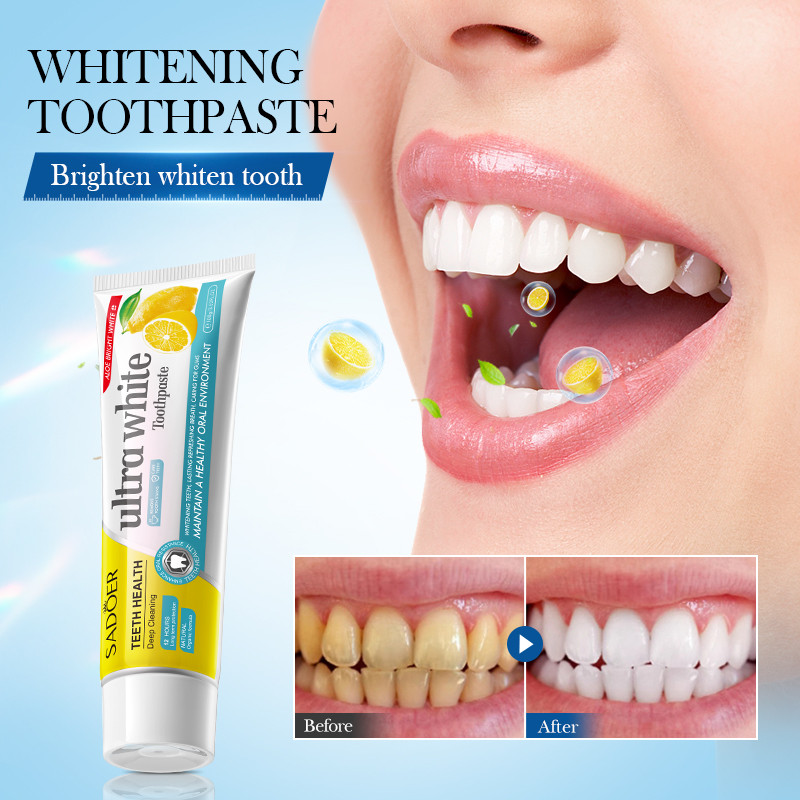 SADOER Ultra White Lemon Teeth Whitening Toothpaste Brighten Teeth ...
