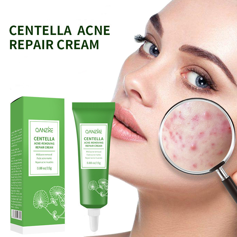 Picture of Centella Asiatica Herbal Acne Removal Cream Gently Lighten Acne Marks ...