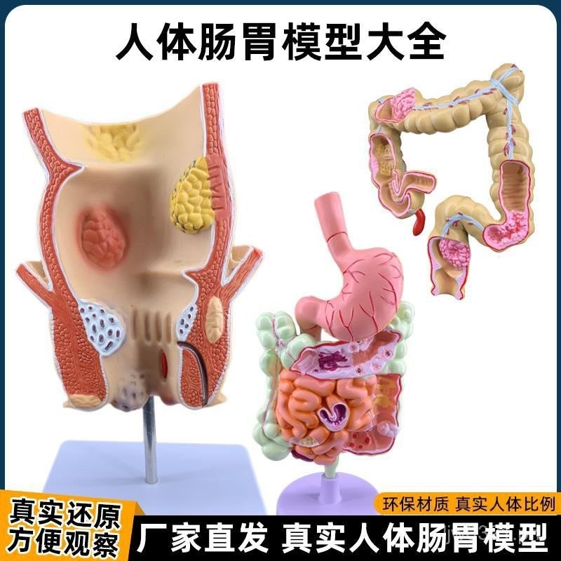 Pathological Structure Intestinal Duodenum Demonstration Digestive ...