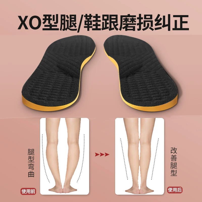 Adult o Type x Type Calf Valgus Correction Insole Bowlegs Artifact Leg ...
