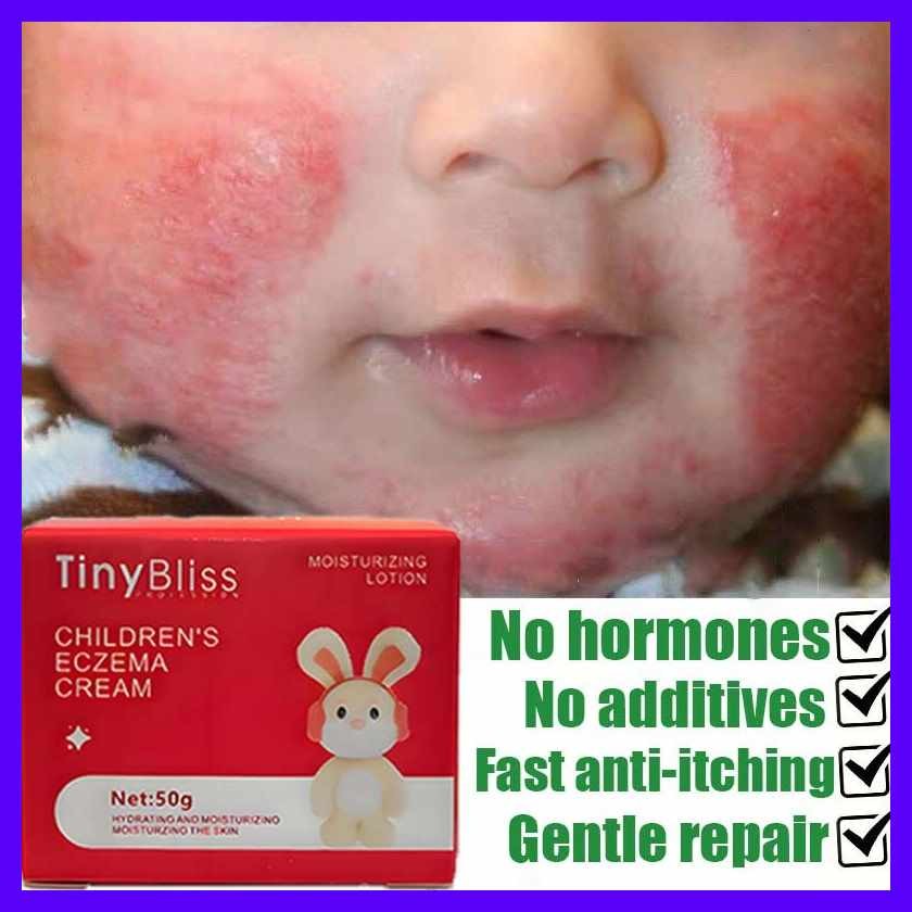 TinyBliss!tY|Baby|A~Eczema%ur_Cream:TS_Antiseptic:hg_Healing:DT_Cream ...