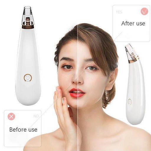 【COD】Today Market Vacuum Blackhead Extractor - Deep Pore Cleaning Tool ...