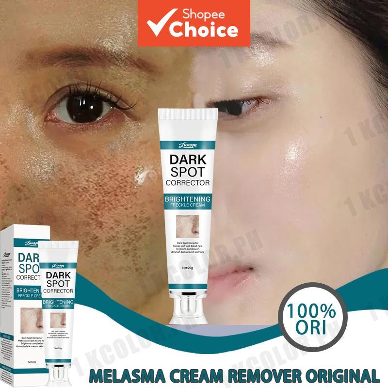 Melasma Cream Pekas Remover Pekas Cream | Original Dark Spot Remover ...