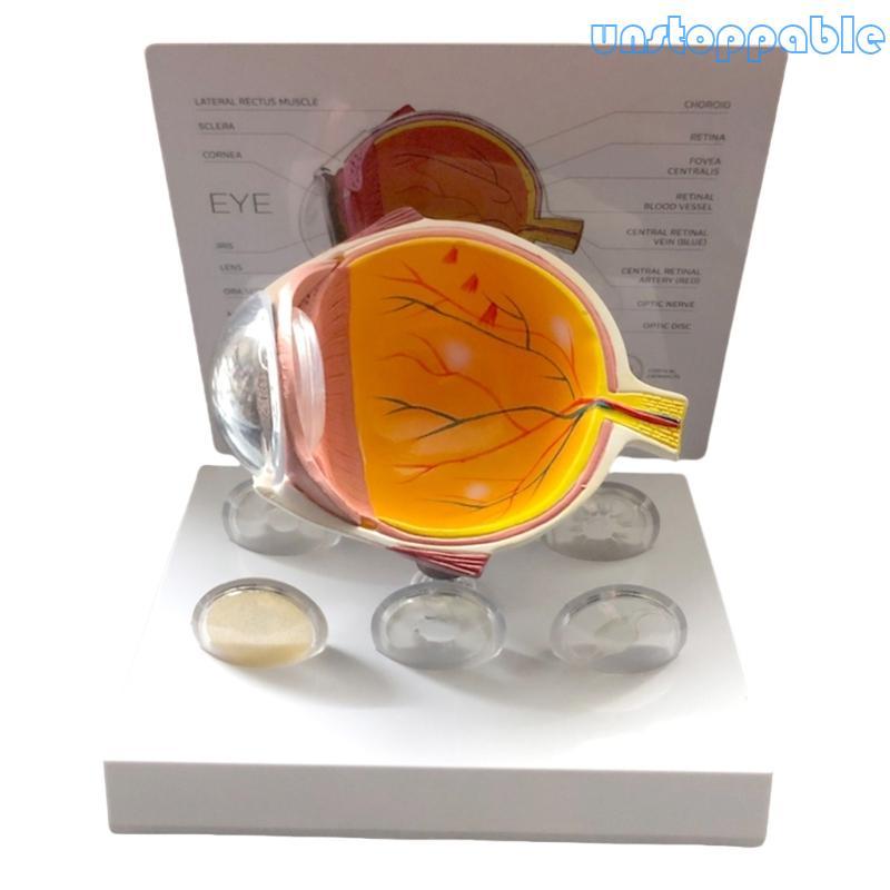 un* Human Anatomical Eye Model Pathological Eyeball Anatomy Model for ...