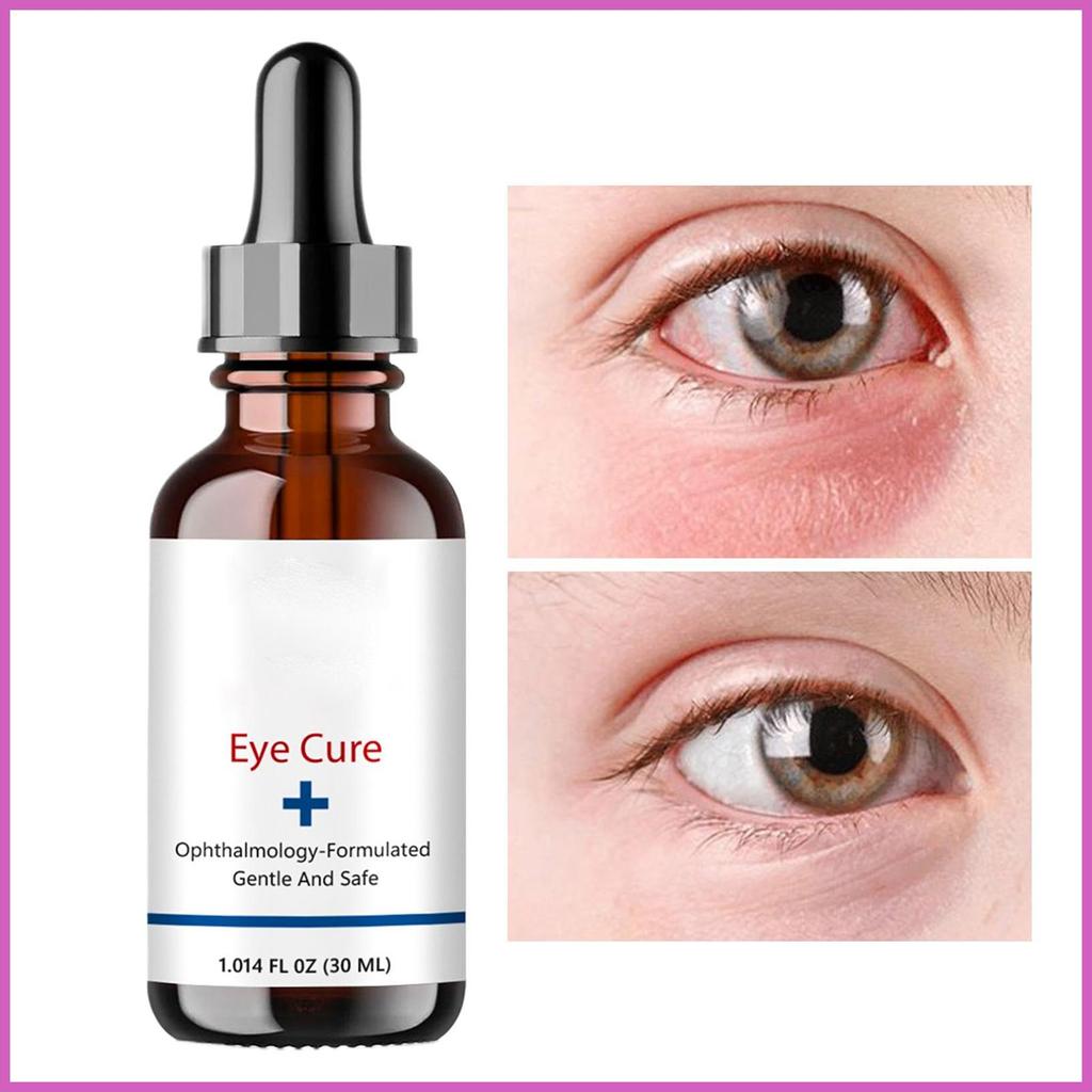 Eye Wash Solution 30ml Nourishing Cleaning Liquid for Dry Eyes Natural ...
