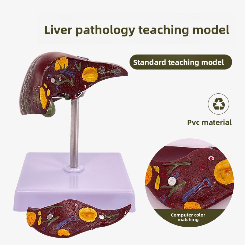Liver Pathology Model Fat Model Liver and Gallbladder Model Lesion ...