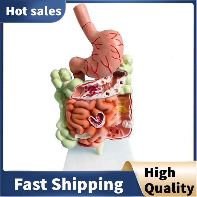 In Promotion Human Digestive System Model Stomach Anatomy Large ...