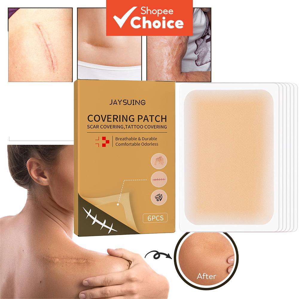 Tattoo Cover up Patches, Waterproof & Sweatproof Cuttable Skin Tone ...