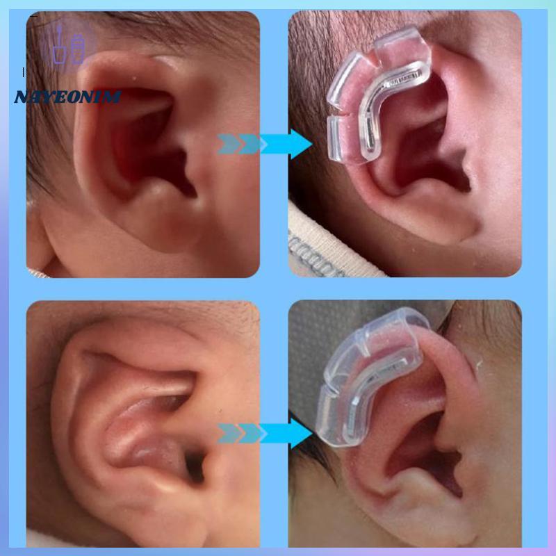 NAY Protruding Ear Support Infant Corrector Tools Silicone Auricle ...