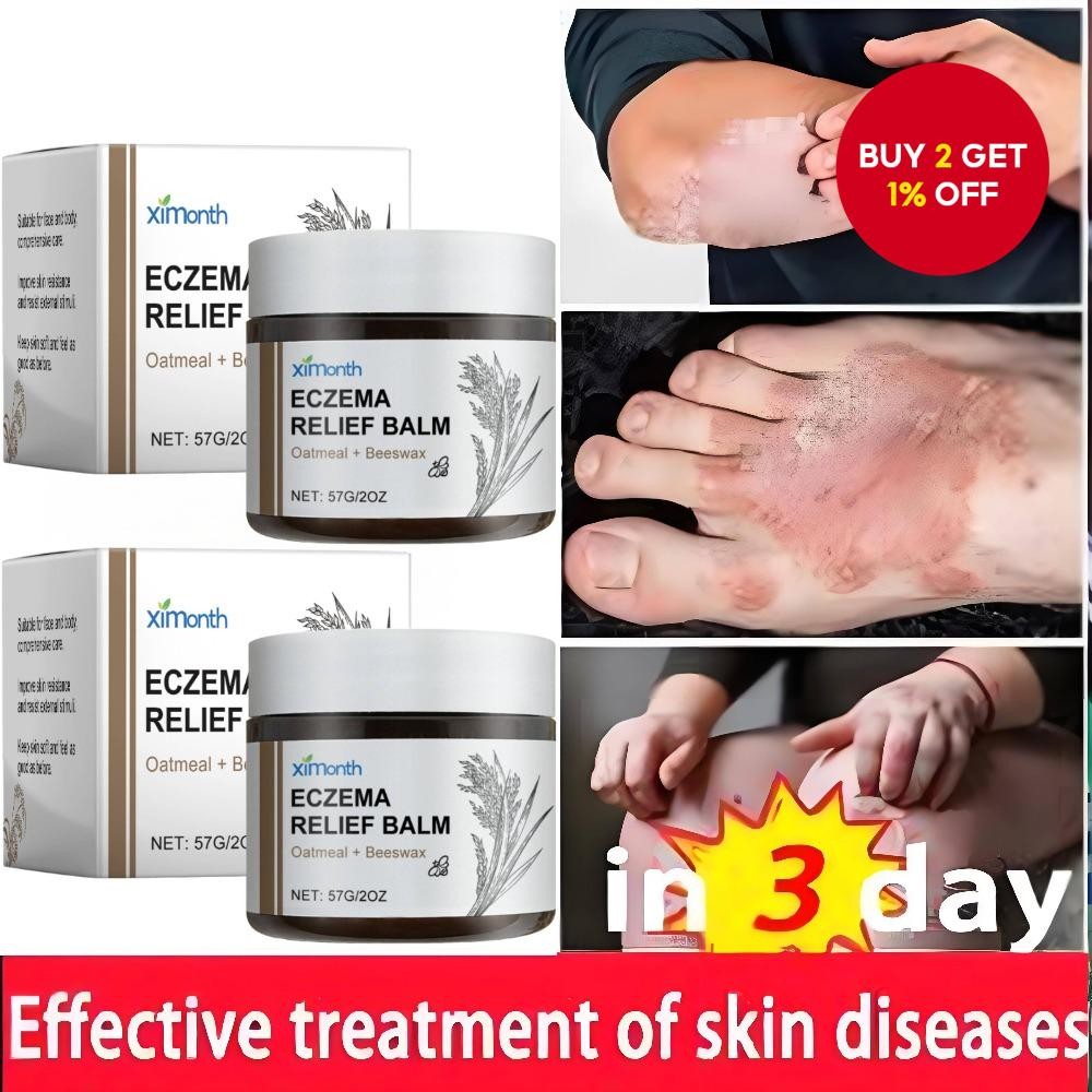 Eczema Relief Cream for Dry, Itchy, and Irritated Skin - Soothing Cream ...