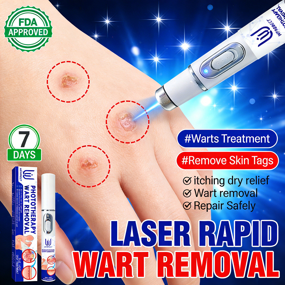 Laser removal of various skin tags (flat warts / filiform warts ...