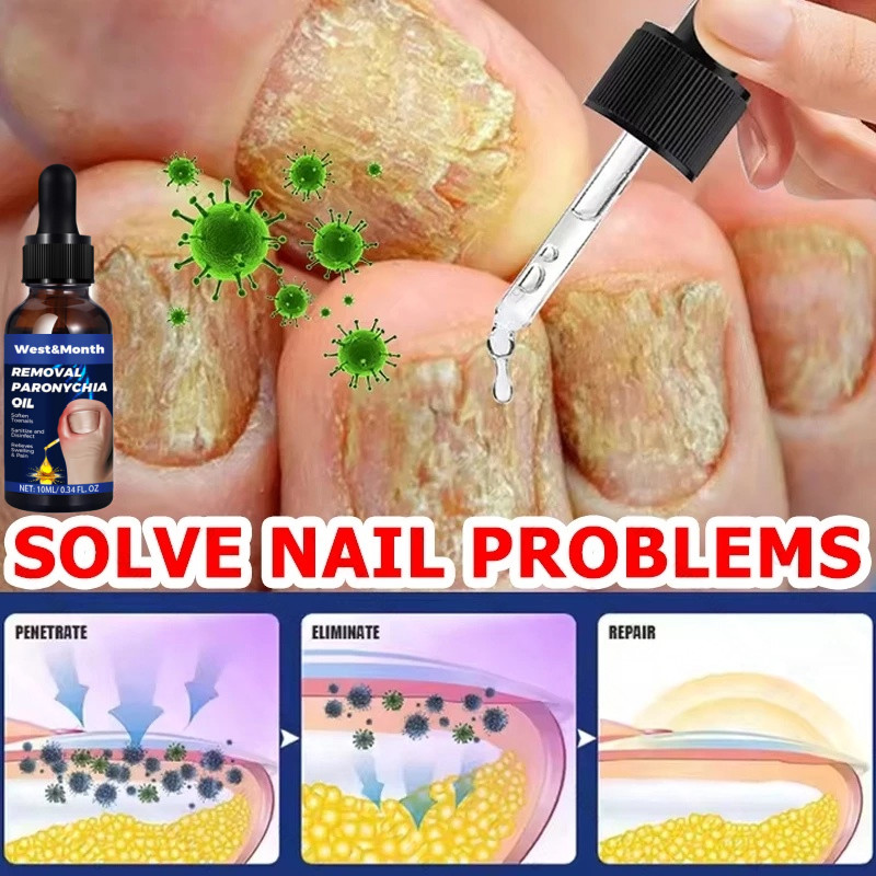 Ingrown Toenail Repair Essence Anti Paronychia Relief Oil para sa Pag-aayos  ng Kuko