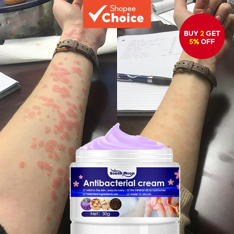 Antibacterial Ointment Cream for Itchy and Skin Disease Like Allergy ...