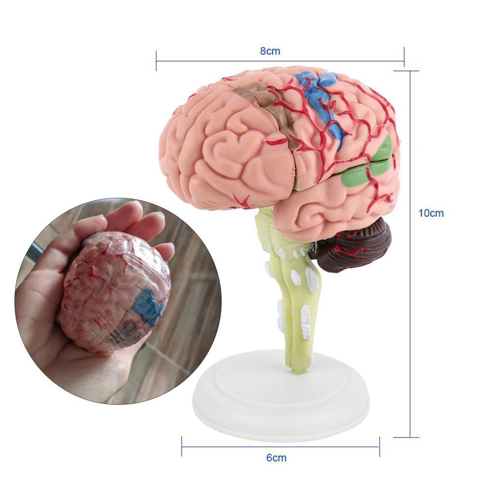 Globedealwin Disassembled Human Brain Model Anatomical Science ...