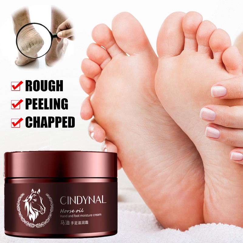 CINDYNAL Milebel Horse Oil Foot Cream Anti Dry Heel Repair Cream 110g |  Shopee Philippines